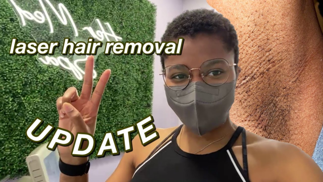 MY LASER HAIR REMOVAL EXPERIENCE ON DARK SKIN | AFTER SESSION RECAPS